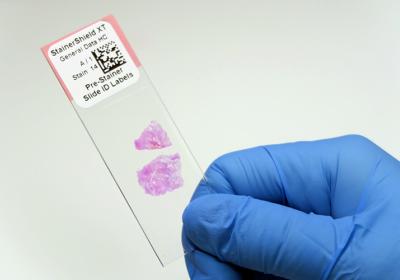 Slide Labeling Needs More Than Just A Xylene-Resistant Label
